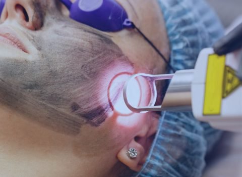 AT Laser Treatments AT Laser Treatments