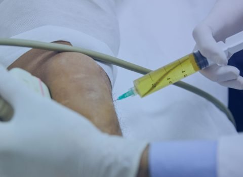 CELL THERAPY Autologous SVF