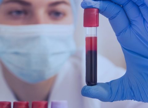 DIAGNOSTIC Health Screening (Blood Test)