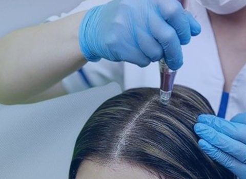 EXOSOMES for Hair