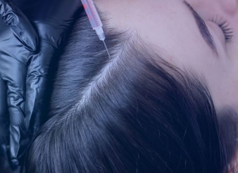 PRP Hair